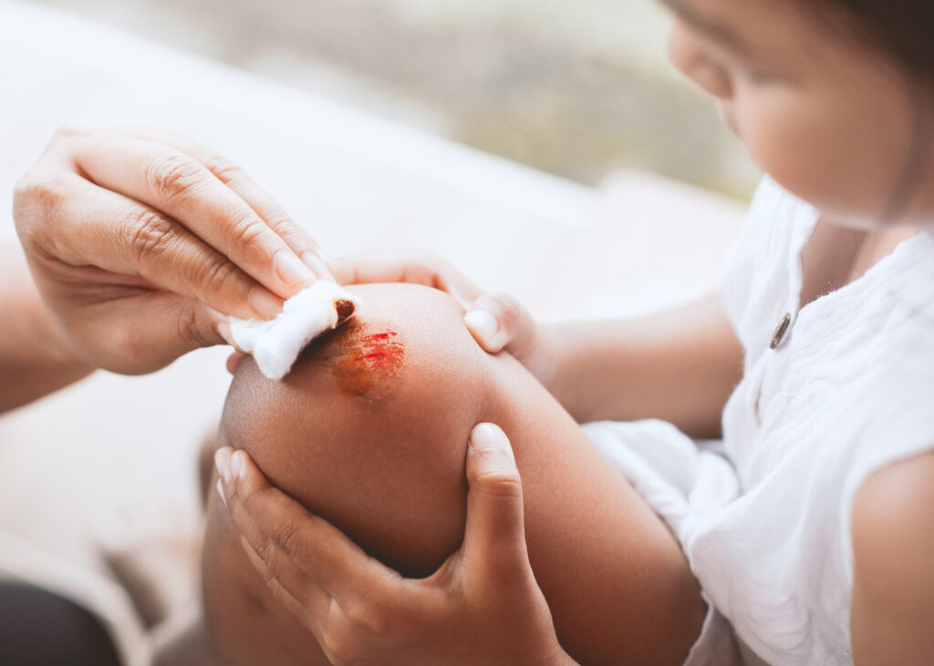 Child suffering from knee injury at a California summer camp.